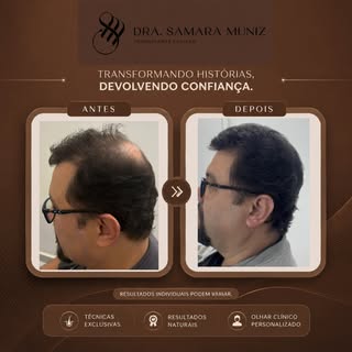 Resultados que valorizam a naturalidade.
Tratamento capilar personalizado, com acompanhamento em cad