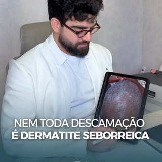 Nem toda descamação no couro cabeludo é dermatite seborreica. ⚠️

Coceira, vermelhidão, descamação e