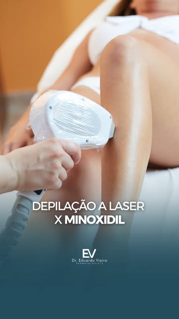 Começou a usar minoxidil e percebeu mudanças nos pelos do corpo? Isso pode gerar dúvidas, principalm