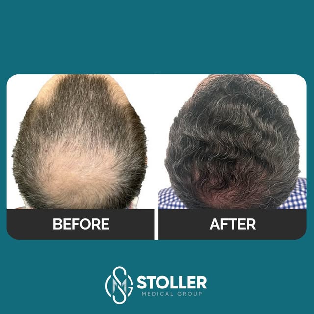 Crown restoration done right.👑

This is one of the most dramatic crown transformations we've seen—f
