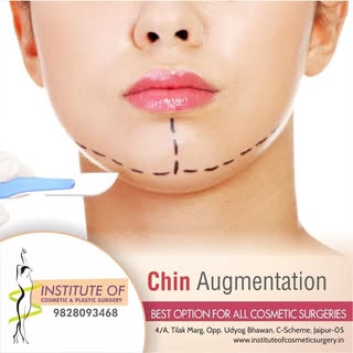 A chin augmentation refers to refinement/improvement of the bone contour of the chin area. This is u