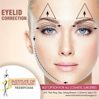 Eyelid lift surgery can help restore a naturally youthful, refreshed appearance to tired-looking, ag