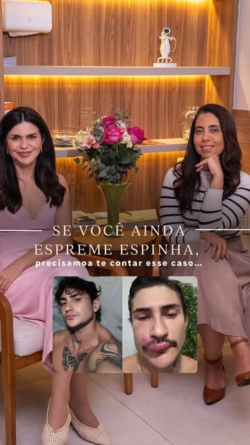Você também já ouviu falar que espremer uma espinha nessa região do rosto pode ser perigoso?

Nós sa