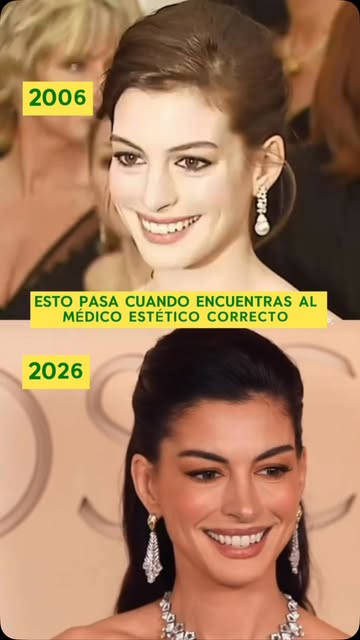 20 años separan estas imágenes… y la evolución de Anne Hathaway es simplemente espectacular. ✨

De 2