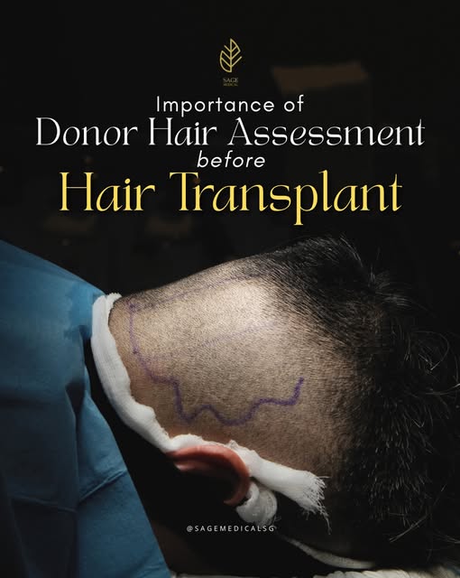 It’s not just about where you’ve lost hair, it’s about the hair you have available to restore it.

B