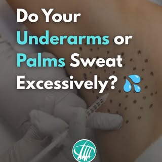 Before you let excessive sweating affect your confidence, know that there’s a solution. 💦

If your 