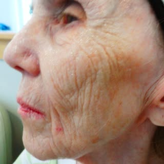 We've been turning back time, for years.
Book a free skin consult and lock in our sale!
(518) 383-33
