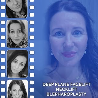 Rebecca is proof that aging backwards is possible. 💙

-
MCAN Health is accredited by the Turkish Mi