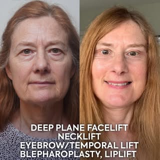 Some transformations don't need words—they speak for themselves. 💙

Her before and after results re