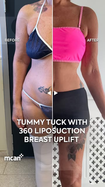 When shape meets proportion, the whole silhouette changes. 💙

Sally Anne’s before-and-after transfo