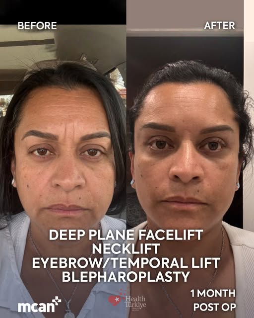 Laura’s new look has entered the chat. ✨

After her full facelift, Laura’s transformation has brough