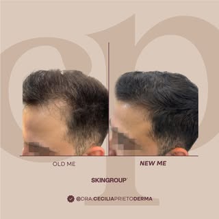 Un cuidado constante puede marcar la diferencia en la densidad y apariencia del cabello

◽Cada trata
