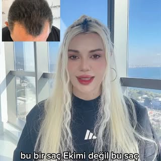 Detaylara takıntılı bir yaklaşım,doğru teknik ve doğal sonuçlar.
Bizimle iletişime geçin👇🏻
📱 0 (5