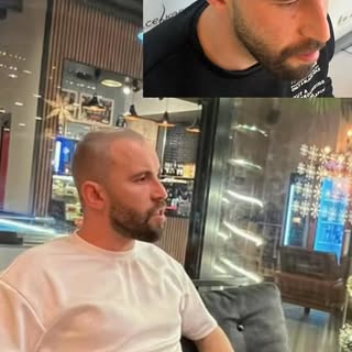 “İşlem sonrası danışanımızdan gelen bu görüntü aslında her şeyi anlatıyor…
Kendi çekip gönderdiği bu