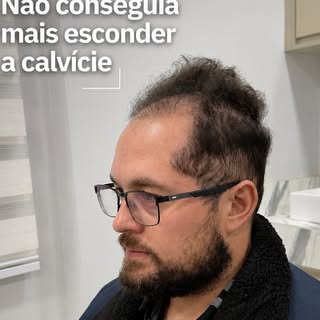 Me conte - o que você já fez para esconder a sua calvície?
#
Por isso, o pós-imediato não representa