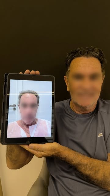 Algumas transformações vão além da aparência. Elas mudam a forma como você se enxerga.

O transplant