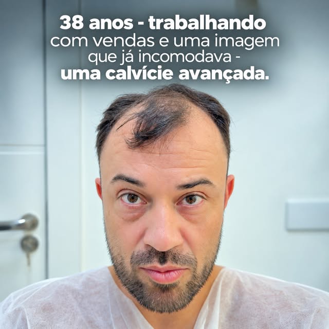 A evolução deste caso evidencia a importância de distribuir os folículos de acordo com as prioridade