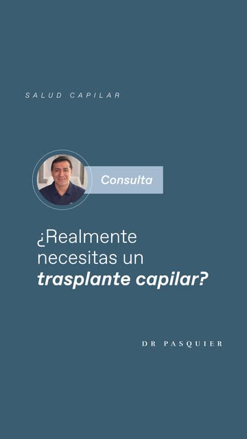 El PRP puede formar parte de un tratamiento capilar, aunque su aplicación responde a las necesidades