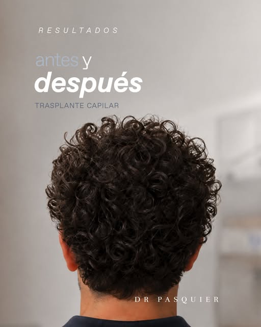 Detrás de este antes y después hay meses de evolución, seguimiento y un tratamiento pensado específi