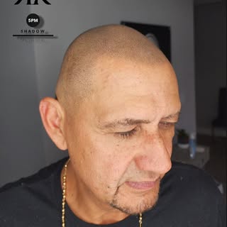 Brought back to life with a brand new natural soft widow's peak style hairline.
He said he already m