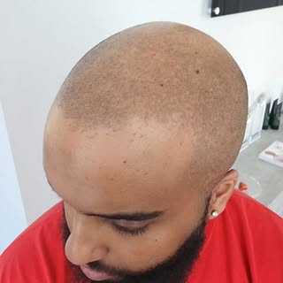 Hard but undetectable and natural.
3 sessions in and we have youth instantly restored.
New man for t