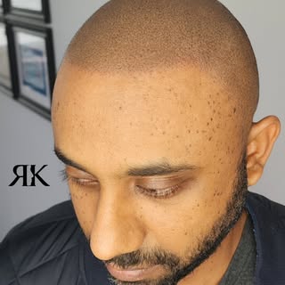 Aight we back it 🙏🏼💯
Failed hair transplant brought back to life. Semi-soft round edge up style o