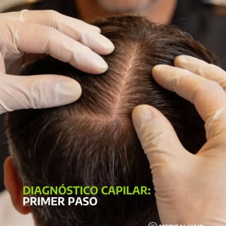 Antes de hablar de tratamientos, hay una pregunta clave: ¿qué está pasando realmente en tu cuero cab