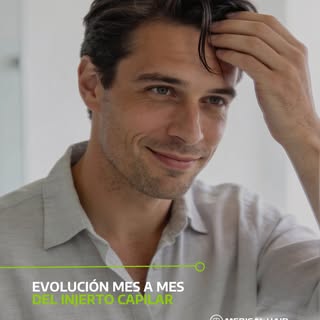 Una de las dudas más comunes: «¿Cuándo voy a notar cambios?»

La evolución tras un injerto es progre
