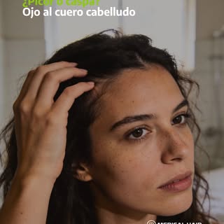 En invierno solemos hablar de caída, pero muchas veces el «problema» empieza antes: en el cuero cabe