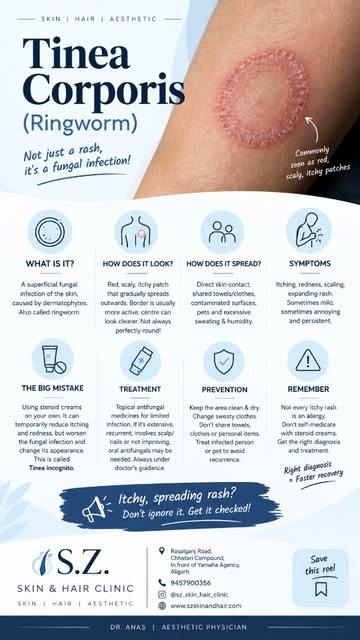 🚨 Not every itchy rash is an allergy!

That red, itchy, spreading, ring-like patch could be Tinea C