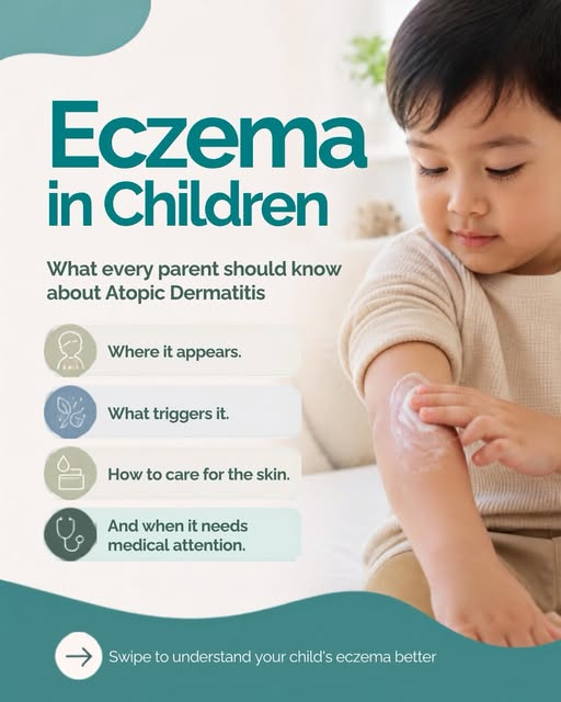 Eczema in children can be more than just dry skin. The itching, redness and recurring flares can be 