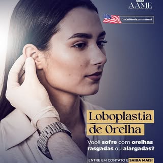 Temos técnica diferenciada que não envolve a retirada de parte do lóbulo da orelha. Conseguimos o re