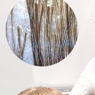 Have you ever had a scalp and/or hair assessment, or do you know someone who can benefit from one?

