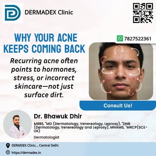 If acne keeps returning, it’s time to treat the root cause—not just the pimple. #AcneCare #Dermatolo