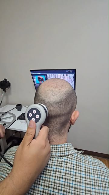 Take hair and scalp analysis to the next level with FotoFinder — an advanced AI-powered technology d