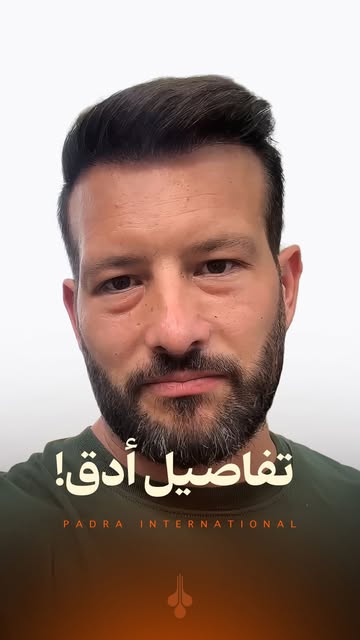 ٦ أشهر… والفرق واضح. ✨
كثافة أفضل، خط شعر طبيعي، ونتيجة تعكس دقة التفاصيل. 🤍
📍 بواسطة شركة بادرا إ