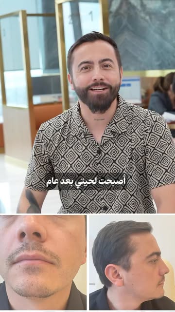 كثافة أكثر… ولحية بمظهر طبيعي ومتناسق. 🤍✨
📍 بواسطة شركة بادرا إنترناشيونال لحجز المصحات العلاجية

