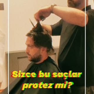 Sizce hangisi protez? 😉 Bizce ayırt etmek imkansız! %100 doğal görünüm ve kişiye özel tasarım ile s
