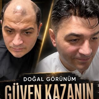 Değişim sadece saçla başlar, ama orada bitmez. 😎 Yeni bir imaj, tazelenen bir özgüven! Doğuş Hair D