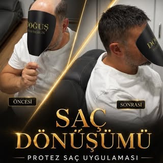 Değişim sadece saçla başlar, ama orada bitmez. 😎 Yeni bir imaj, tazelenen bir özgüven! Doğuş Hair D