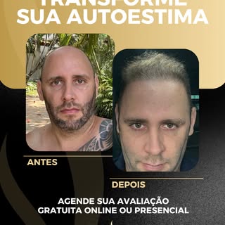Transforme sua autoestima e volte a se olhar no espelho com orgulho! ✨
Confira o resultado incrível 