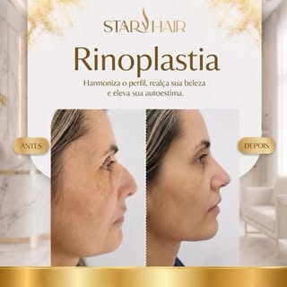 ✨ A Star Hair evoluiu para cuidar ainda mais de você!

Agora, além do nosso reconhecido Transplante 