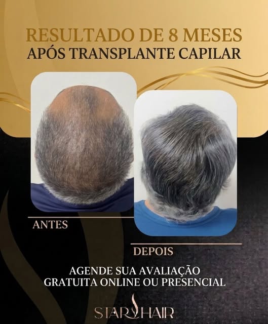 🚀 8 meses de transformação e ainda não chegamos ao resultado final!

Esse é o resultado de um trans
