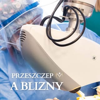 Czy po przeszczepie włosów zostają blizny? 🤔

To jedno z najczęściej zadawanych pytań przed zabiegi