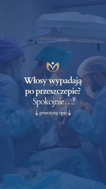 Włosy wypadają 2–4 tygodnie po przeszczepie? Spokojnie - to może być tzw. shock loss.

Wypadanie wło