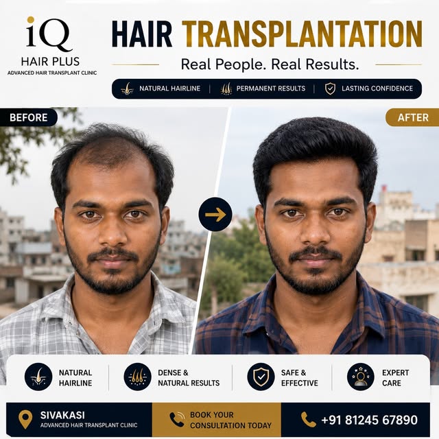Your hair journey starts with the right consultation. 💙

📍 iQ HAIR PLUS
Advanced Hair Transplant C