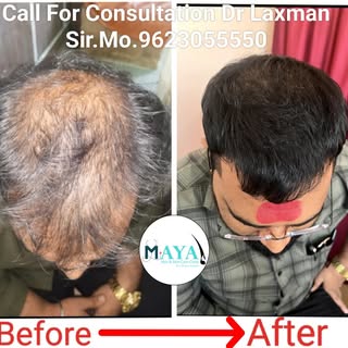 8 Months Results.  #happiness #hair #hairtyle #hairstyle #haircoloring #haircolor #blondehair #longh