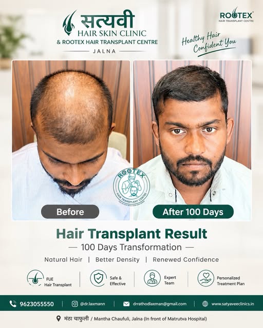 BALD TO BOLD – A New Beginning! ✨
बाल फक्त दिसण्यासाठी नाहीत…
ते आपल्या Confidence आणि Personality च