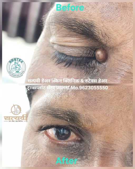 #jalna #satyaveeclinic #drlaxman #drlaxmanrathod #