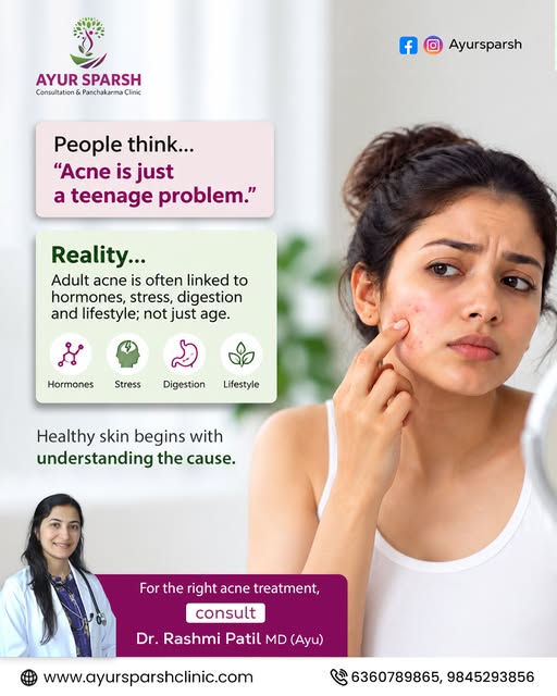 Adult Acne Isn’t “Just a Teenage Problem” — Here’s the Reality!

Still struggling with acne even aft